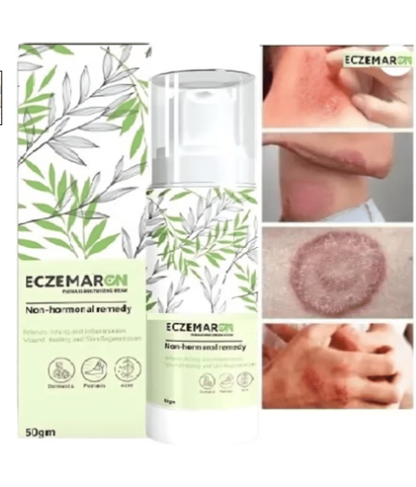 Treszo Moisturizer All Skin Type Aloe Vera ( 50 gm )