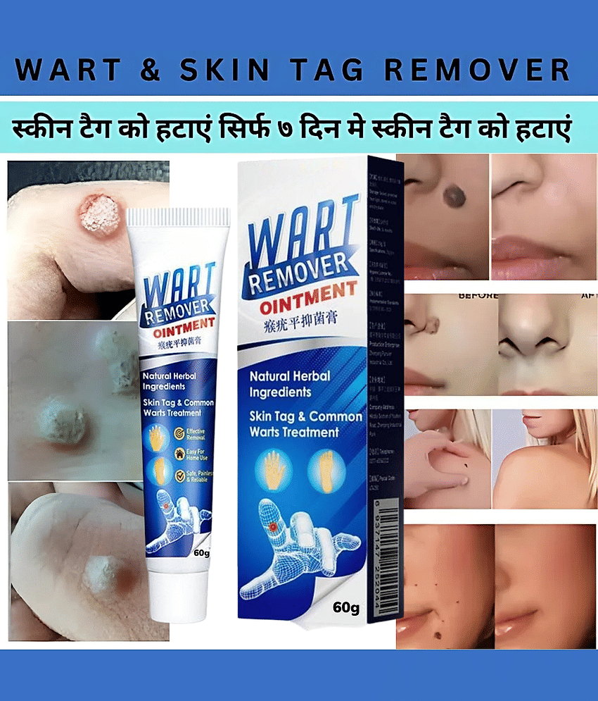 Wart Remover - Painless and Scar-Free Solution Use For Men & Women
