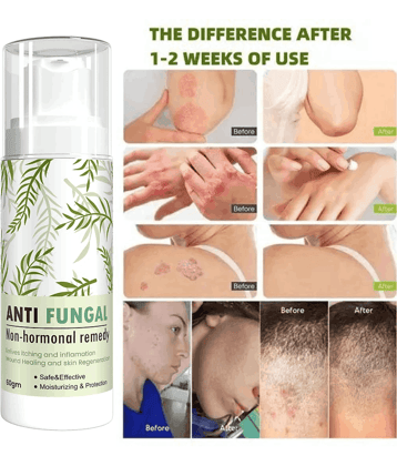 GRASHVA ORGANIC Moisturizing Cream For Eczema Skin 50 ml ( Pack of 1 )