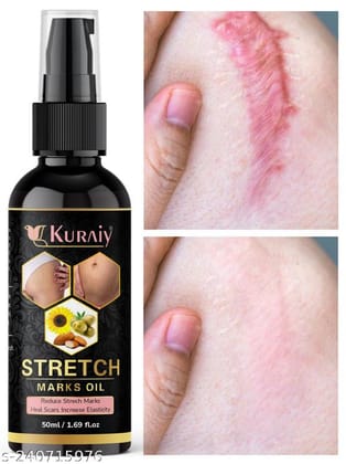 KURAIY  Unique Stretch Marks And Scars Creams & Oils