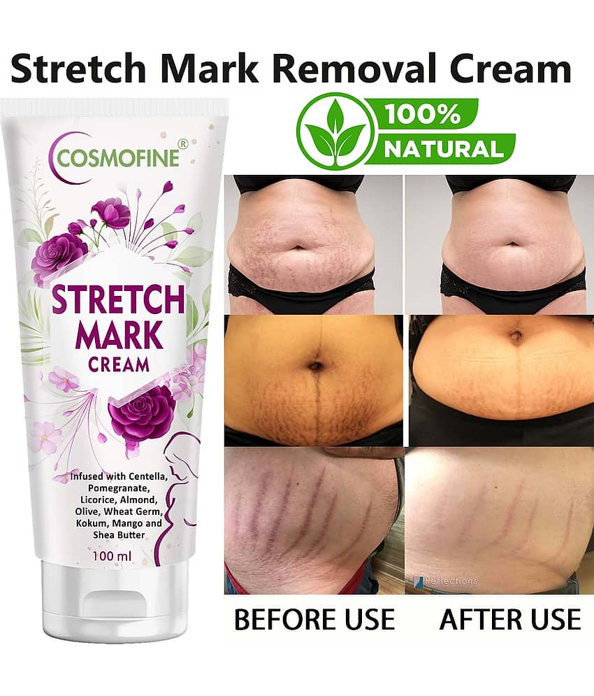 COSMOFINE Skin Tightening Cream, Stretch Mark Cream, Shaping & Firming Cream Floral (100 g)