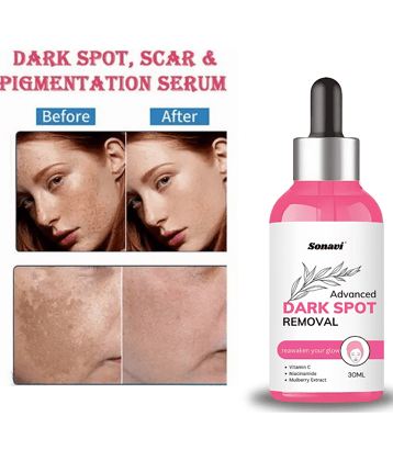 Sonavi Face Serum Niacinamide Retinol Moisturizer For All Skin Type ( Pack of 1 )