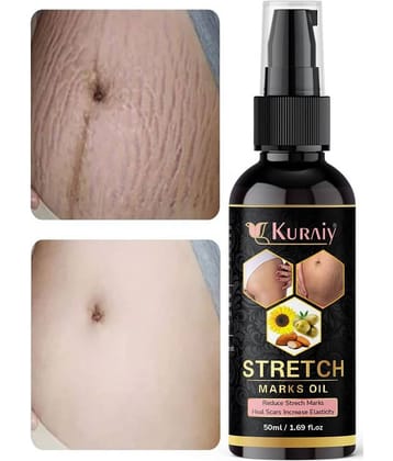 KURAIY Remove Pregnancy Mark Body Cream Treatment Scars Acne Stretch Marks Cream