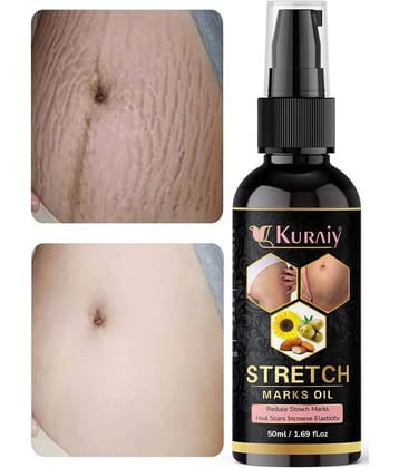KURAIY Remove Pregnancy Mark Body Cream Treatment Scars Acne Stretch Marks Cream