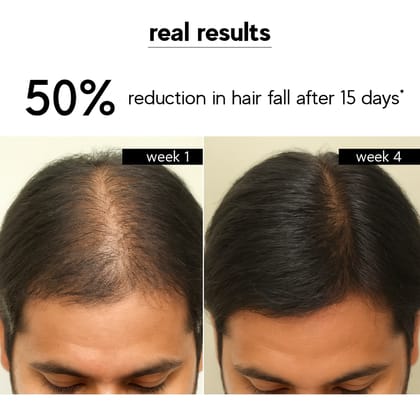 Kuuard Hairfall control Hair Oil | Reduces Hair Fall & Promotes Hair Growth | Rosemary & Gooseberry | 100% Pure & Natural