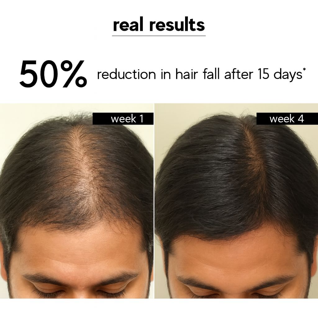 Kuuard Hairfall control Hair Oil | Reduces Hair Fall & Promotes Hair Growth | Rosemary & Gooseberry | 100% Pure & Natural