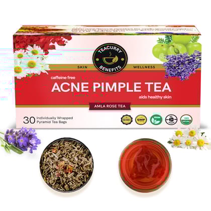 TEACURRY Acne Tea (1 Month Pack | 30 Tea Bags) - Helps in Pimples, Cysts, Pustules & Nodules