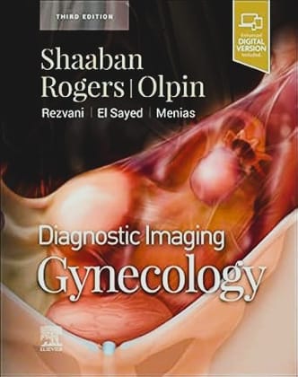 Diagnostic Imaging: Gynecology:  3ed 