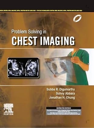 Problem Solving in Chest Imaging, 1ed