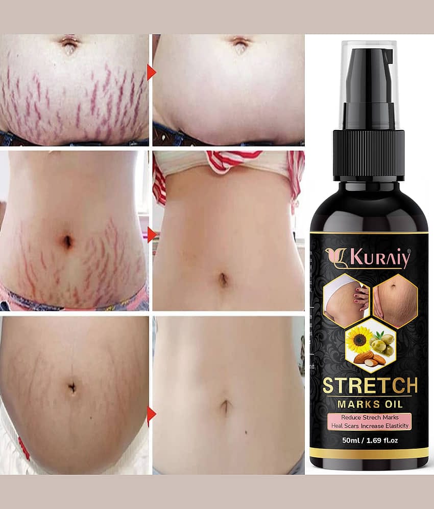 Kuraiy Natural Stretch Oil with Coconut, Olive & Jojoba Oils, For Scars & Stretchmark Oil