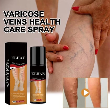 ELHAE Varicose Vein Relief Spray | 30ml Herbal Leg Soothing Formula | Helps Reduce Appearance of Veins & Discomfort | Non-Greasy, Quick Absorbing | Daily Circulation Support
