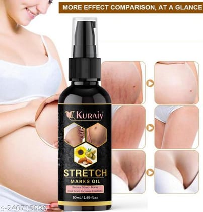 KURAIY  Fancy Stretch Marks And Scars Creams & Oils