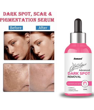 Sonavi Face Serum Niacinamide Retinol Moisturizer For All Skin Type ( Pack of 1 )