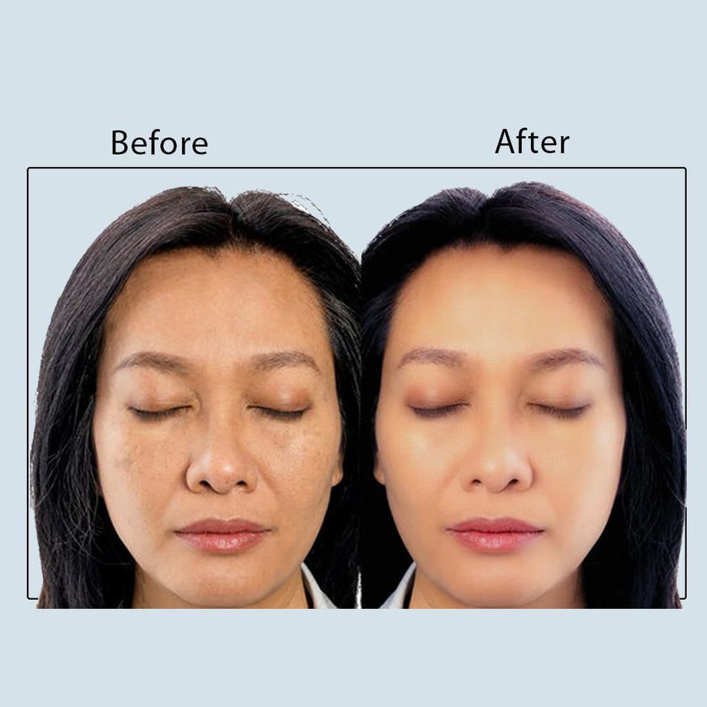 SPRING H2O Diamond Facial Kit 60g | 2-in-1 Brightening & Repair Formula | Enriched with Diamond Powder & Organic Avocado Oil | 6-Step Facial for Glowing Skin