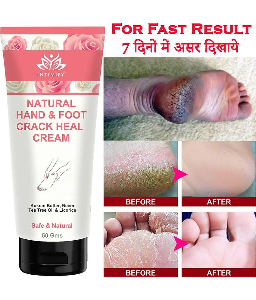 Intimify Cracked Skin Repair Feet Cream, Foot Cream, Cracked Heel Repair, Foot Cream 50 gms