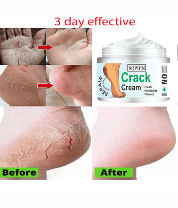 SOPHIN Cracked skin repair Cream for ( 50 g )