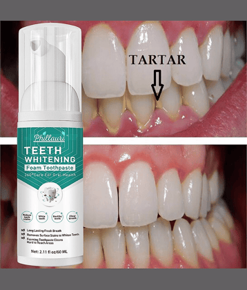 Phillauri Natural Standard Oral Kit