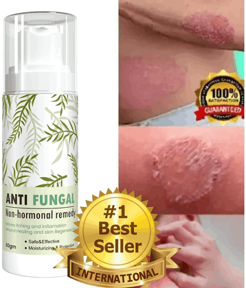 GRASHVA ORGANIC Anti-Itch Cream For Eczema Skin 50 ml ( Pack of 1 )